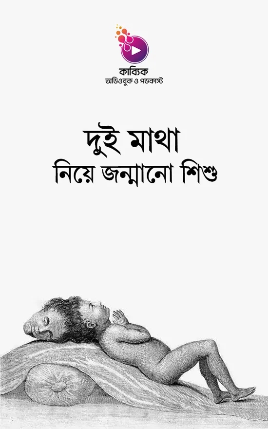 দুই মাথা নিয়ে জন্মানো শিশু_kabbik